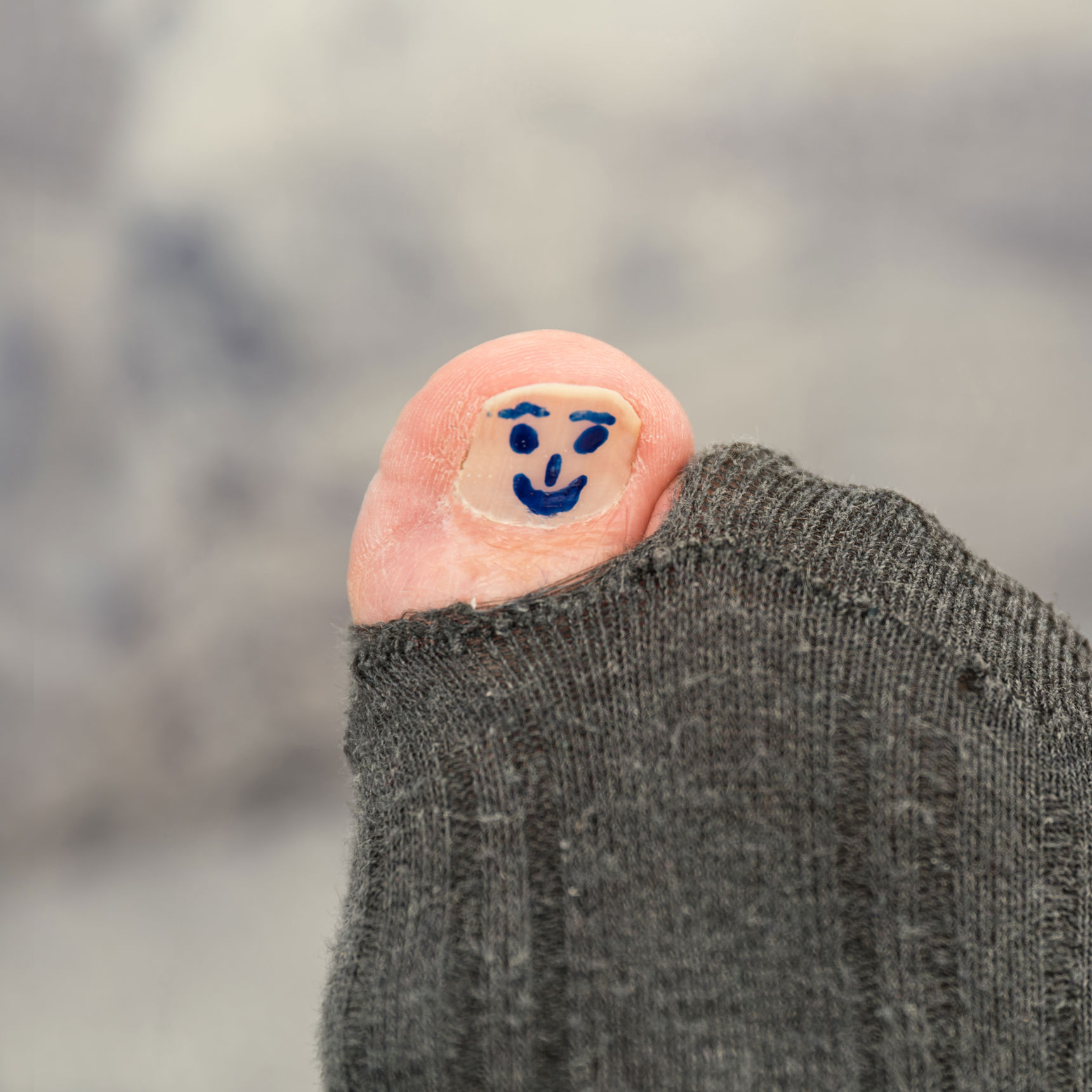 Billede af 2 sokker med hul i