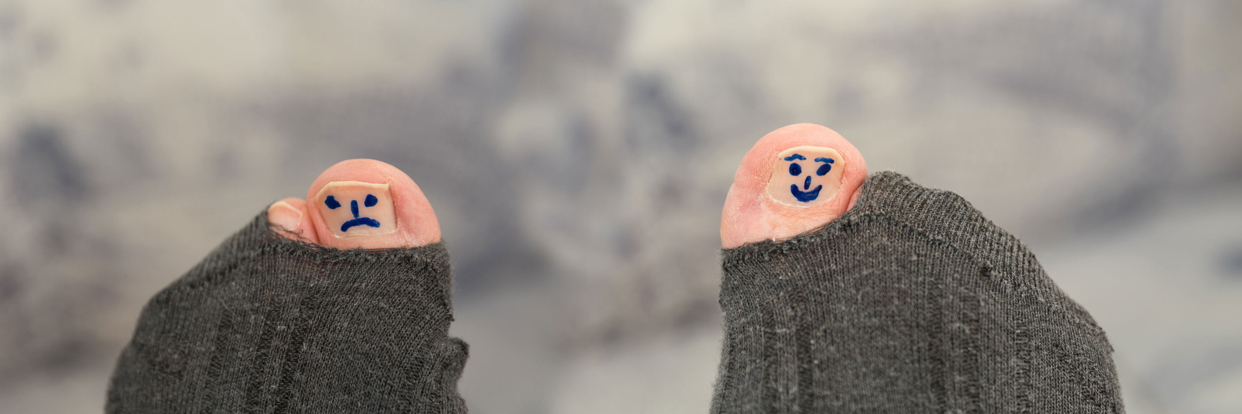 Billede af 2 sokker med hul i